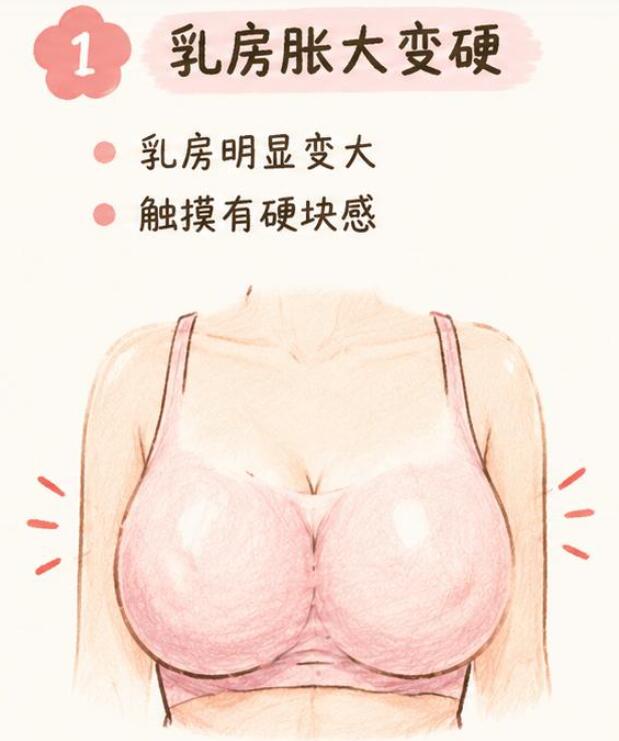 哺乳期乳房水肿有哪些症状表现？别等严重了才重视
