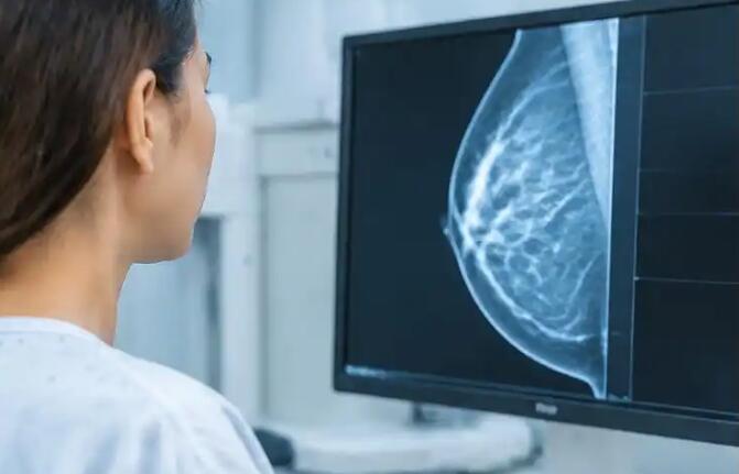 乳头溢液有哪5种类型？医生提醒：分清这几种情况，别把危险信号当成小事