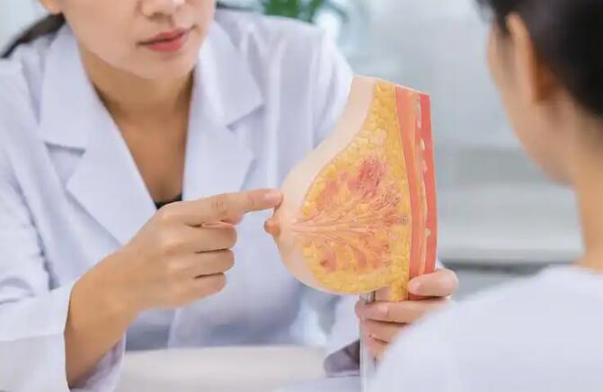 乳头溢液有哪5种类型？医生提醒：分清这几种情况，别把危险信号当成小事