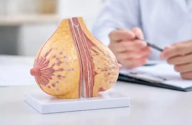 乳房摸到硬块就是癌？医生：先别慌，分清这3种情况再决定