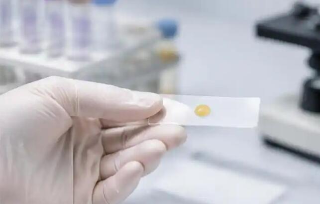乳头溢液哪种是癌？医生：出现这3种颜色，别再拖了