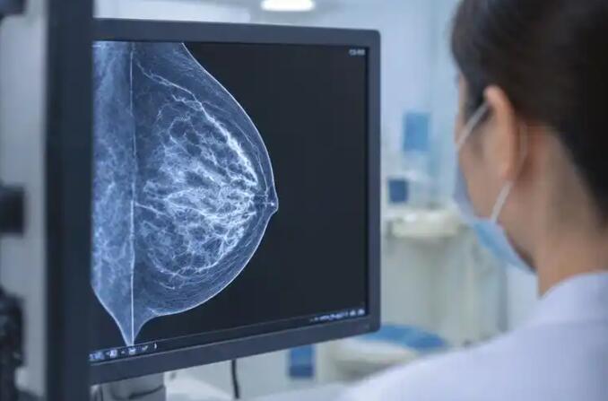 乳头溢液是癌吗？分清5种类型：一种不用管，一种要尽快查